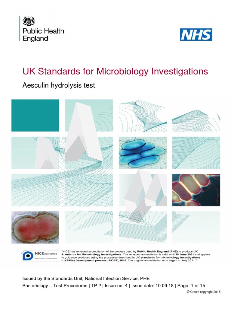 Aesculin Hydrolysis Test: Quick Guide for Microbiologists
Understanding the Aesculin Hydrolysis Test in Microbiology
Aesculin Hydrolysis Test: Essential Lab Technique Explained
How to Perform the Aesculin Hydrolysis Test Effectively
Decoding the Aesculin Hydrolysis Test for Bacterial Identification Aesculin Hydrolysis Test: Quick Guide for Microbiologists
Understanding the Aesculin Hydrolysis Test in Microbiology
Aesculin Hydrolysis Test: Essential Lab Technique Explained
How to Perform the Aesculin Hydrolysis Test Effectively
Decoding the Aesculin Hydrolysis Test for Bacterial Identification
