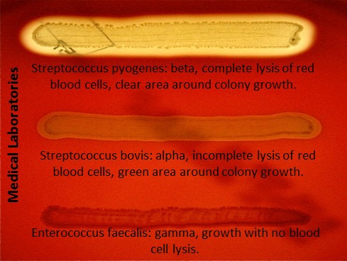 Blood Agar Alpha Beta Gamma Blood Agar Alpha Beta Gamma