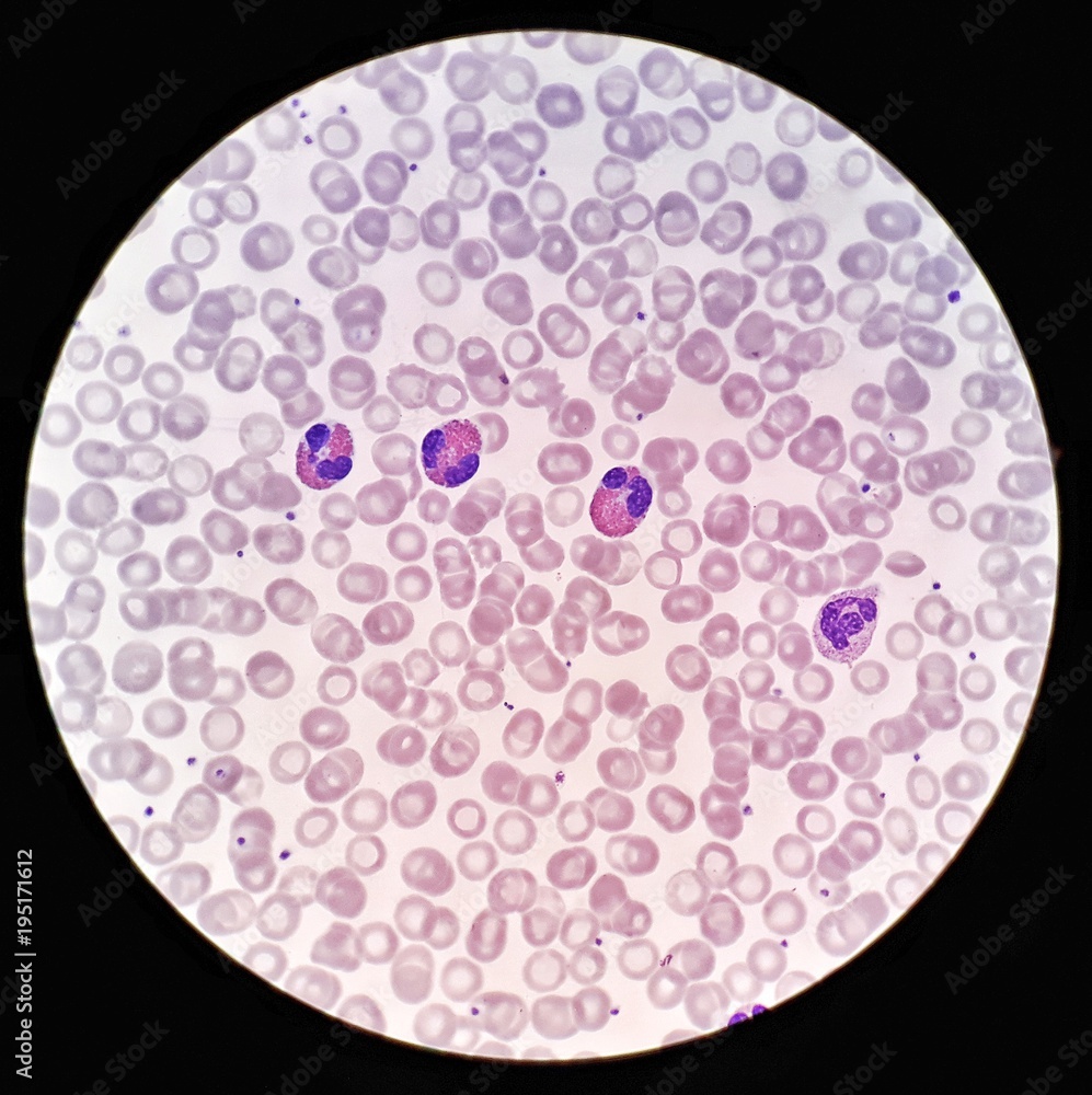 Exploring Blood Cells Under a Microscope: A Visual Guide