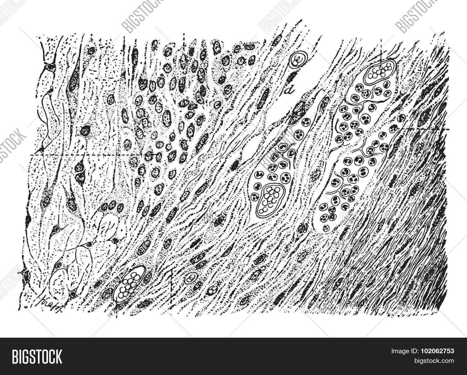 Effective Granular Tissue Treatment Options Explained