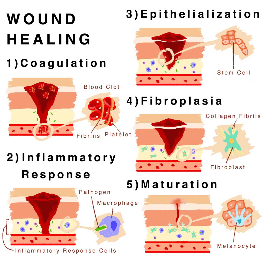 Granulated Skin Healing: Fast Recovery Tips