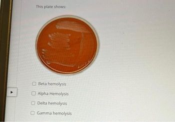 Understanding Hemolysis: Alpha, Beta, and Gamma Explained Understanding Hemolysis: Alpha, Beta, and Gamma Explained
