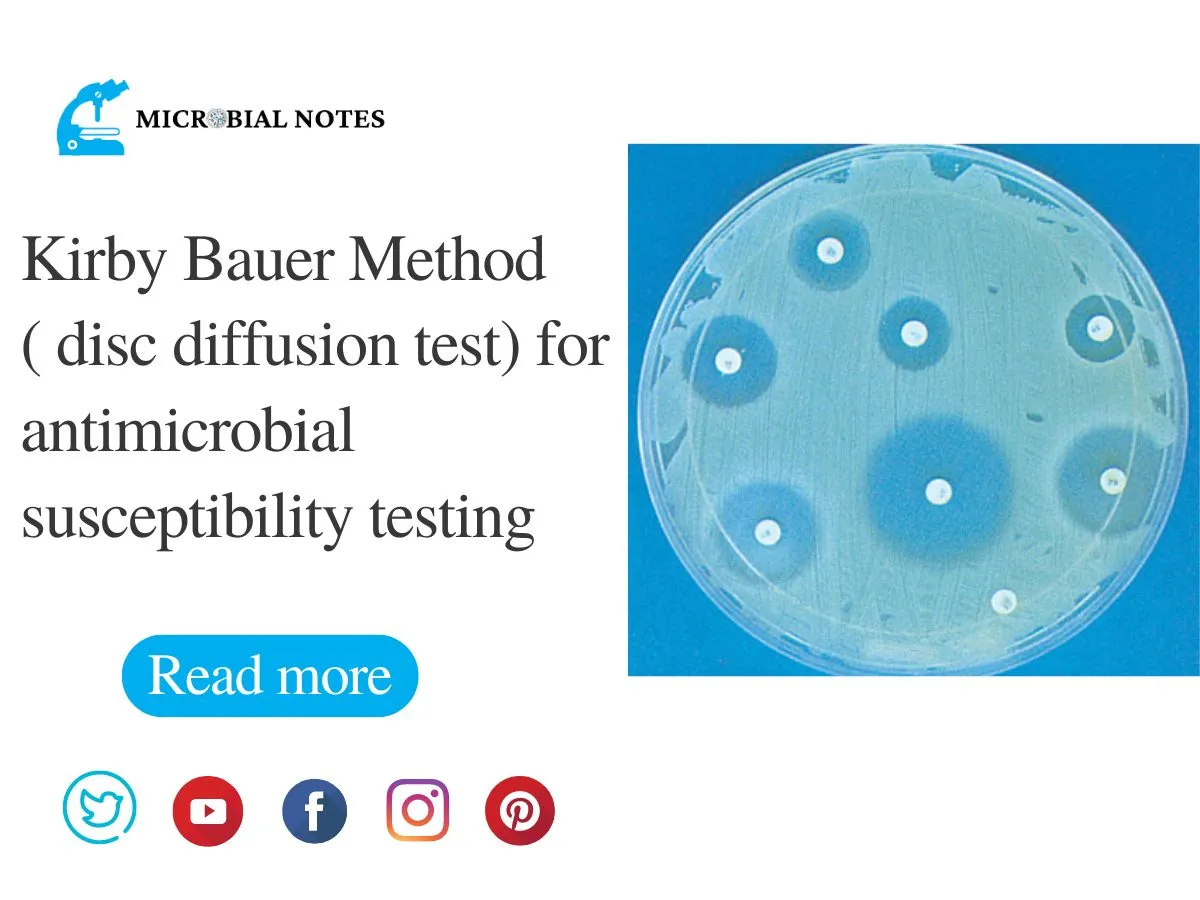 Lab 11 Ast Lab Week 11 Anti Microbial Susceptibility Test Kirby Lab 11 Ast Lab Week 11 Anti Microbial Susceptibility Test Kirby