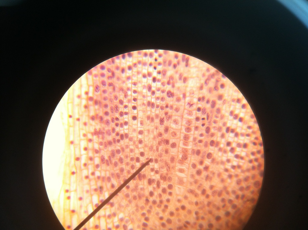 Unveiling Mitosis in Onions: A Cellular Journey