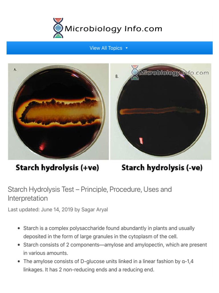 Starch Hydrolysis Test Youtube Starch Hydrolysis Test Youtube