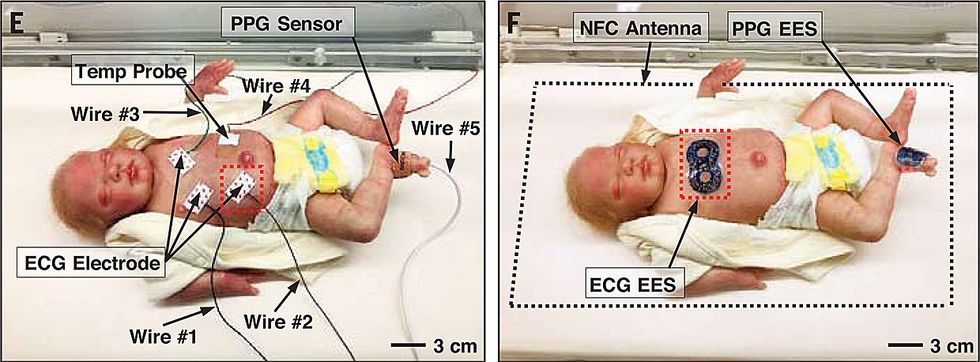 Wireless Skin Sensors For Newborns Will Let Parents Cuddle Fragile