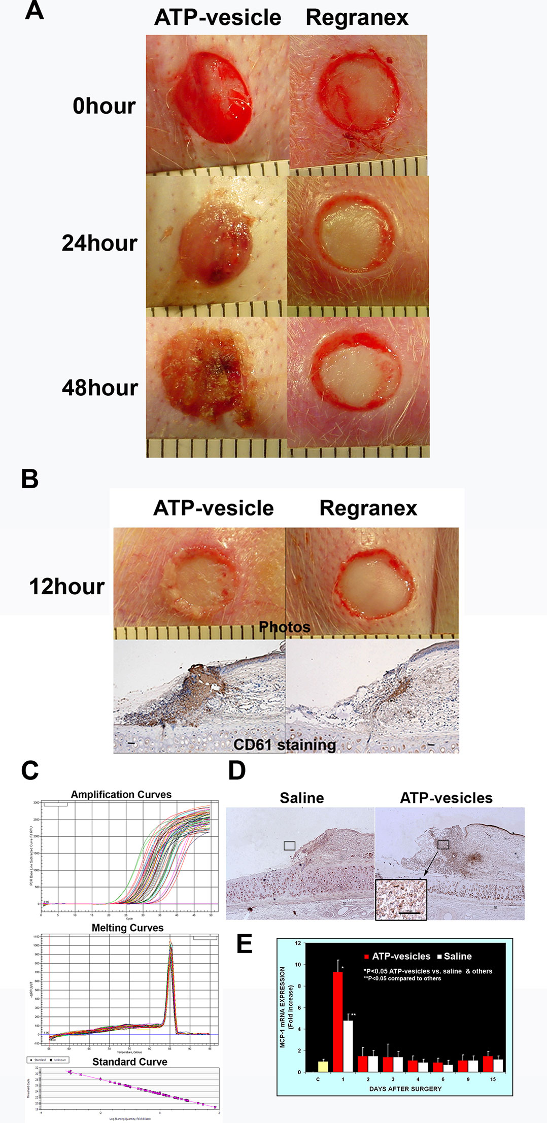 Visual Guide to Wound Granulation Tissue Images